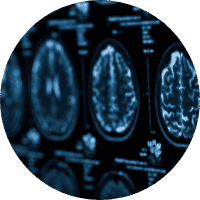 Brain Injuries